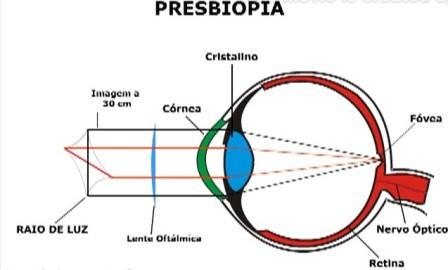 Presbiopia: O que é e por que temos esse problema na visão?